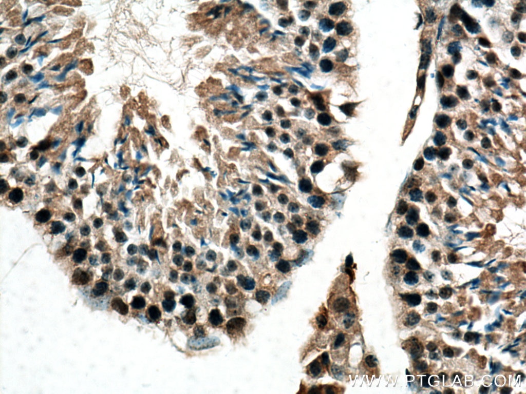 Immunohistochemistry (IHC) staining of mouse testis tissue using DNA-PKcs Polyclonal antibody (28534-1-AP)