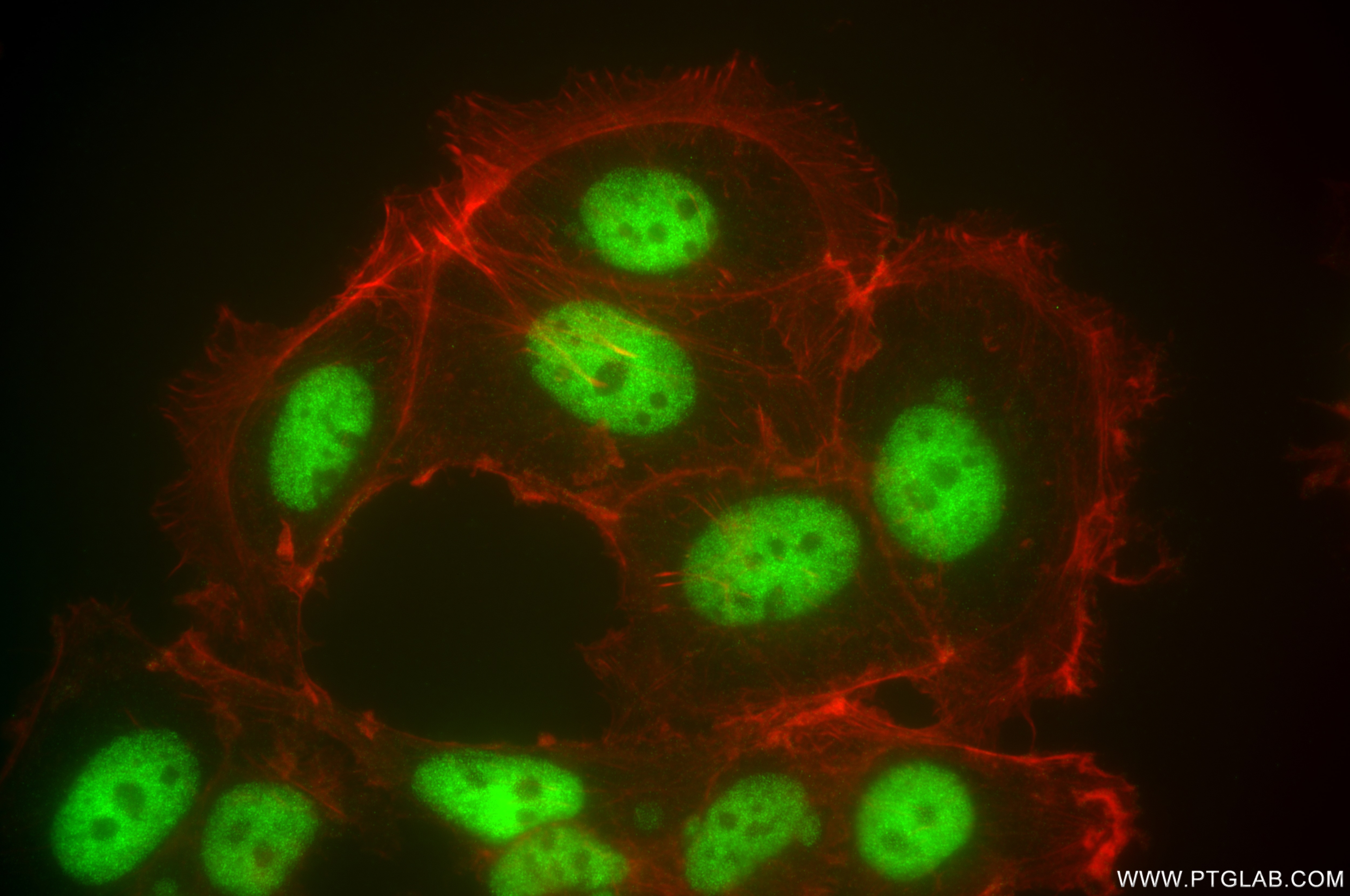 Immunofluorescence (IF) / fluorescent staining of MCF-7 cells using DNA-PKcs Recombinant antibody (85370-2-RR)