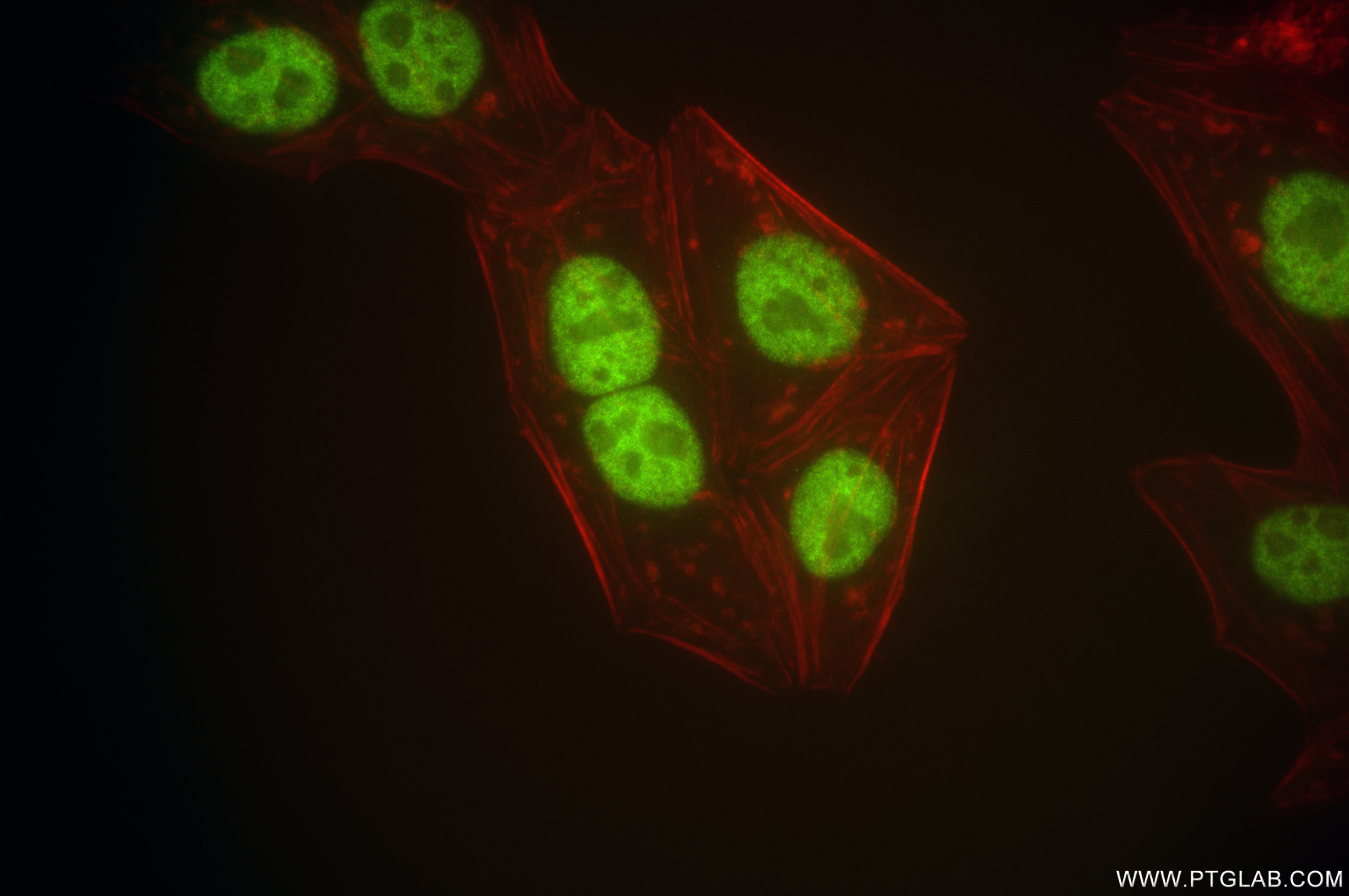 Immunofluorescence (IF) / fluorescent staining of HepG2 cells using DNA-PKcs Recombinant antibody (85370-2-RR)