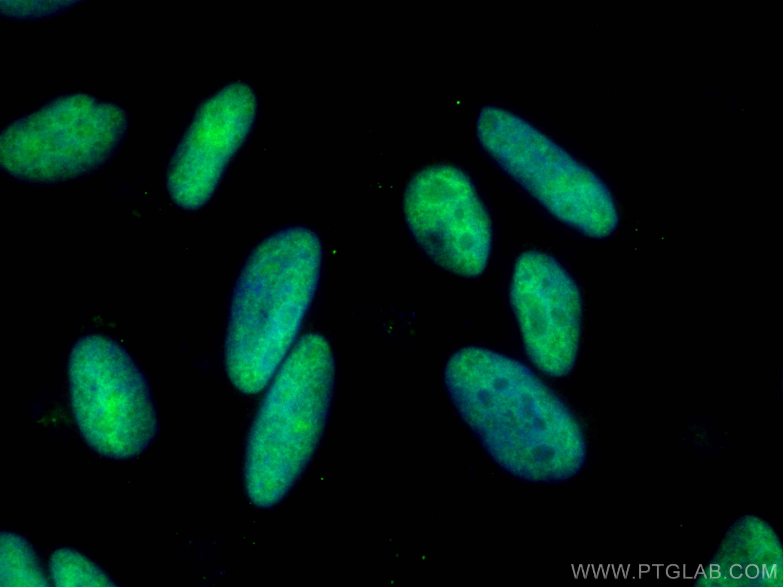Immunofluorescence (IF) / fluorescent staining of HeLa cells using CoraLite® Plus 488-conjugated PRKDC Polyclonal ant (CL488-28534)