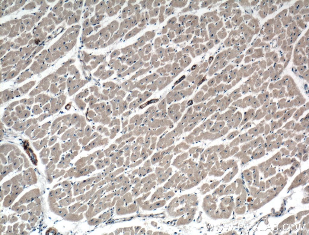 Immunohistochemistry (IHC) staining of human heart tissue using PRKG1 Polyclonal antibody (21646-1-AP)