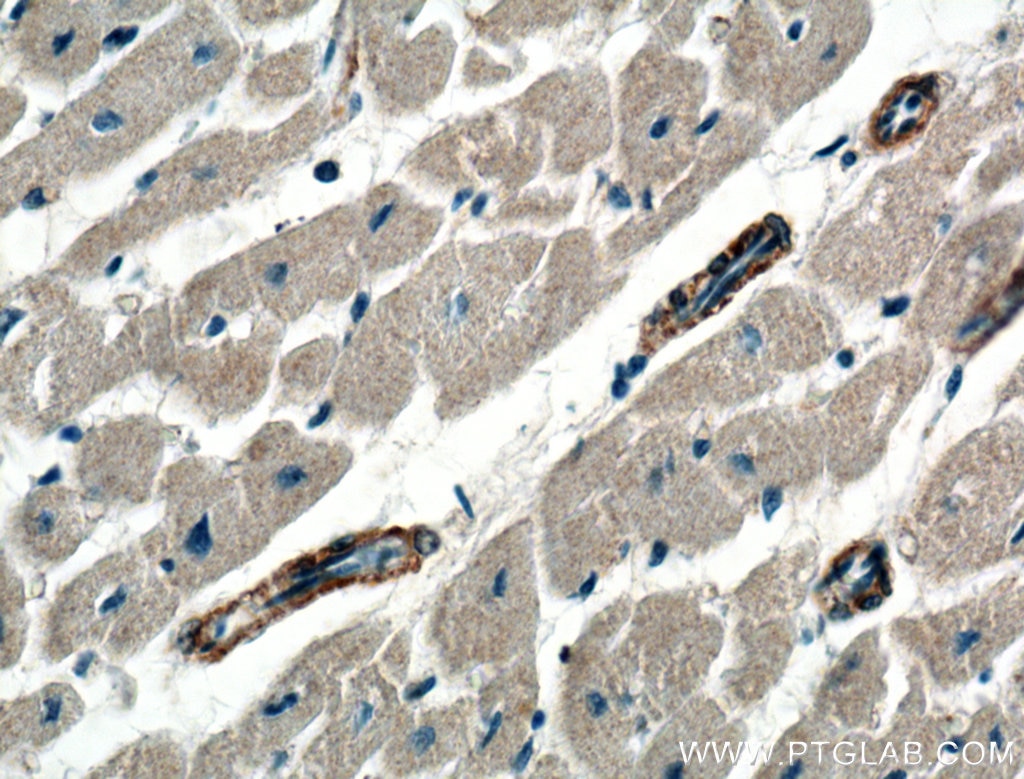 Immunohistochemistry (IHC) staining of human heart tissue using PRKG1 Polyclonal antibody (21646-1-AP)