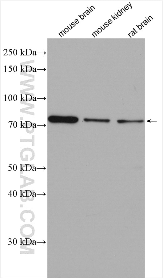 Western Blot (WB) analysis of various lysates using PRKG1 Polyclonal antibody (21646-1-AP)