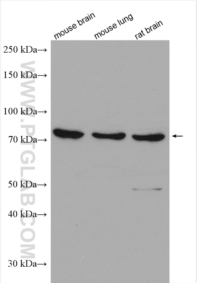 Western Blot (WB) analysis of various lysates using PRKG1 Polyclonal antibody (21646-1-AP)