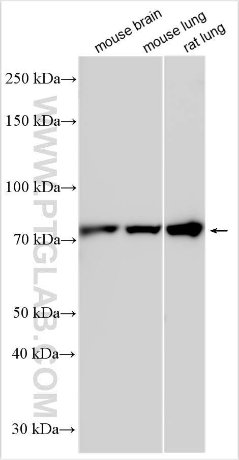 Western Blot (WB) analysis of various lysates using PRKG1 Polyclonal antibody (21646-1-AP)