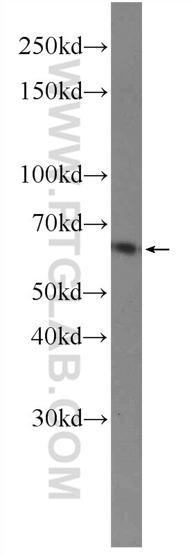 Western Blot (WB) analysis of rat brain tissue using PRKG1 Polyclonal antibody (21646-1-AP)