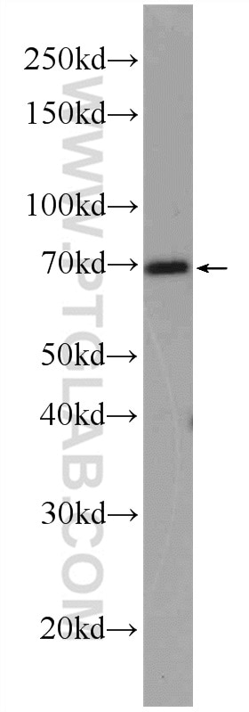 Western Blot (WB) analysis of mouse brain tissue using PRKG1 Polyclonal antibody (21646-1-AP)