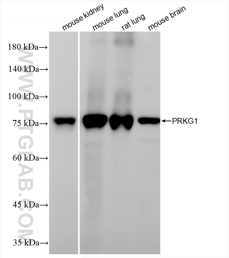 PRKG1