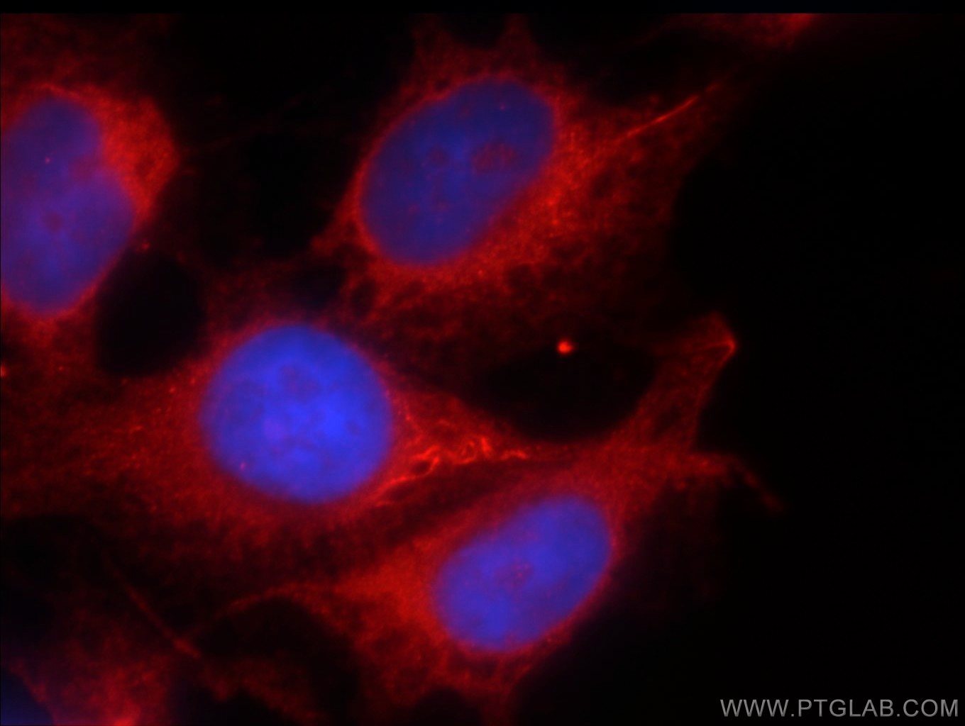 Immunofluorescence (IF) / fluorescent staining of HUVEC cells using PRKG2 Polyclonal antibody (55138-1-AP)