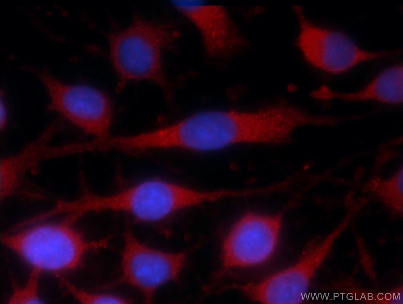 IF Staining of C6 using 55138-1-AP