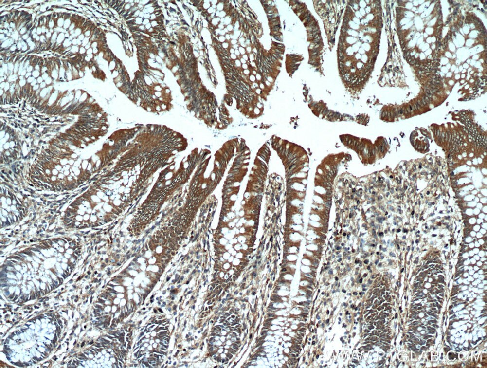 Immunohistochemistry (IHC) staining of human colon tissue using PRKG2 Polyclonal antibody (55138-1-AP)