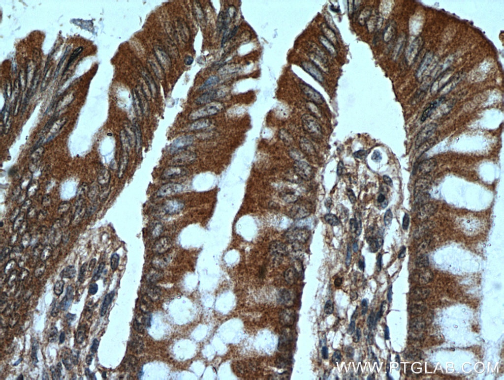 Immunohistochemistry (IHC) staining of human colon tissue using PRKG2 Polyclonal antibody (55138-1-AP)