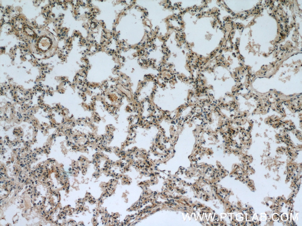 Immunohistochemistry (IHC) staining of human lung tissue using PRKG2 Polyclonal antibody (55138-1-AP)