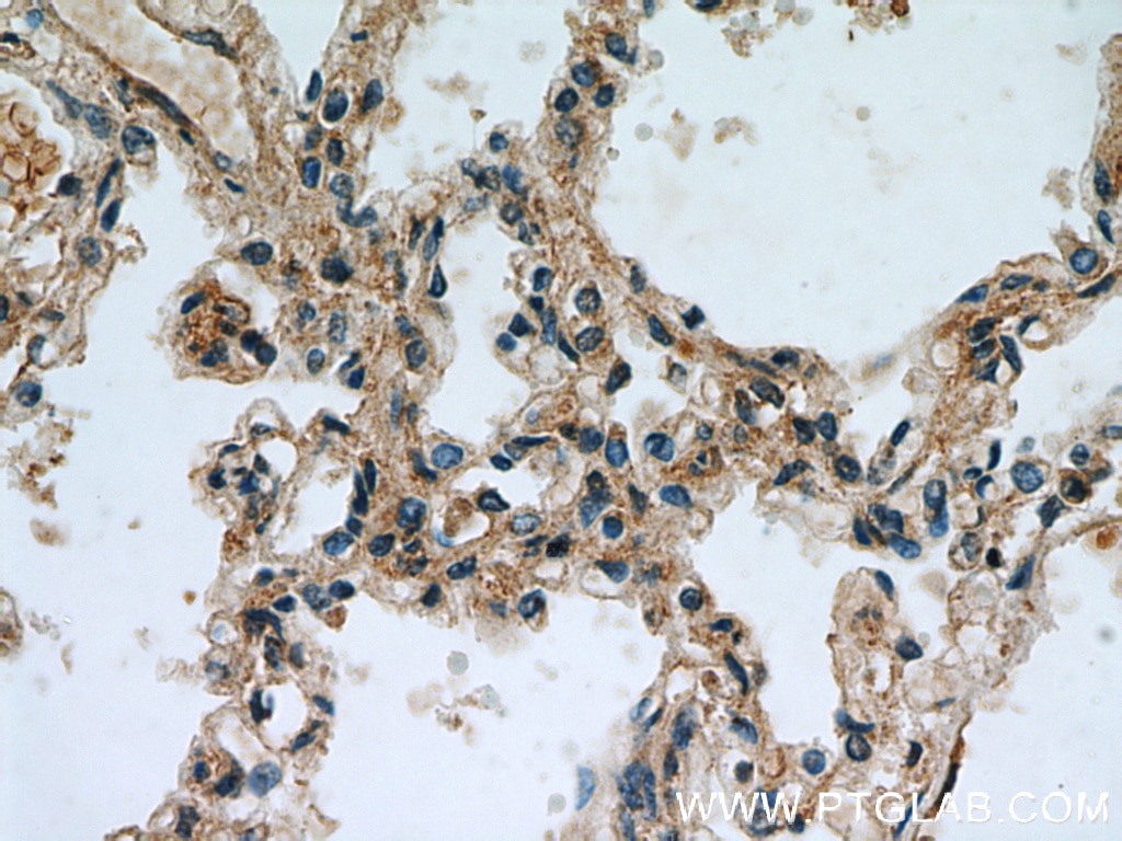 Immunohistochemistry (IHC) staining of human lung tissue using PRKG2 Polyclonal antibody (55138-1-AP)