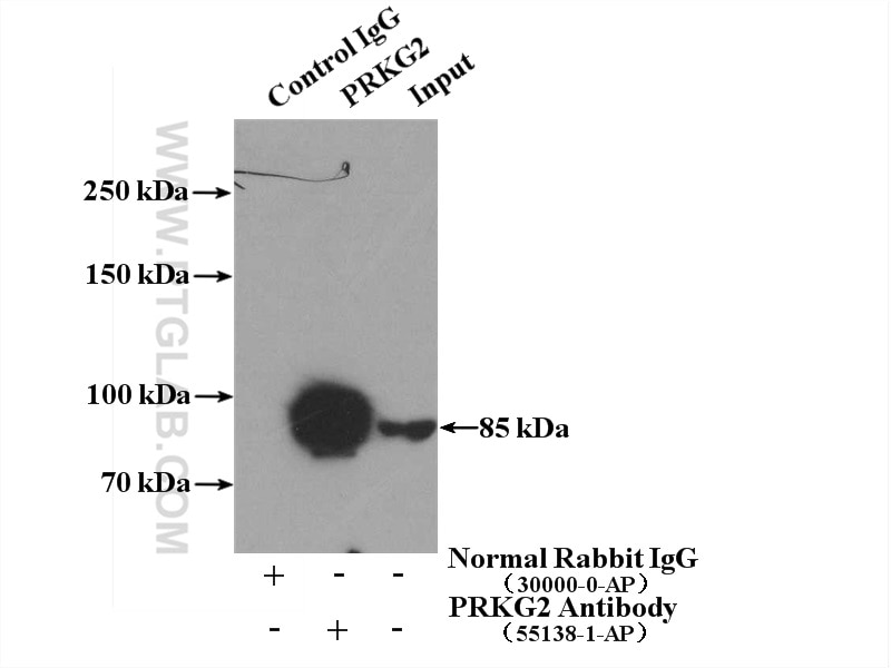 Immunoprecipitation (IP) experiment of mouse brain tissue using PRKG2 Polyclonal antibody (55138-1-AP)