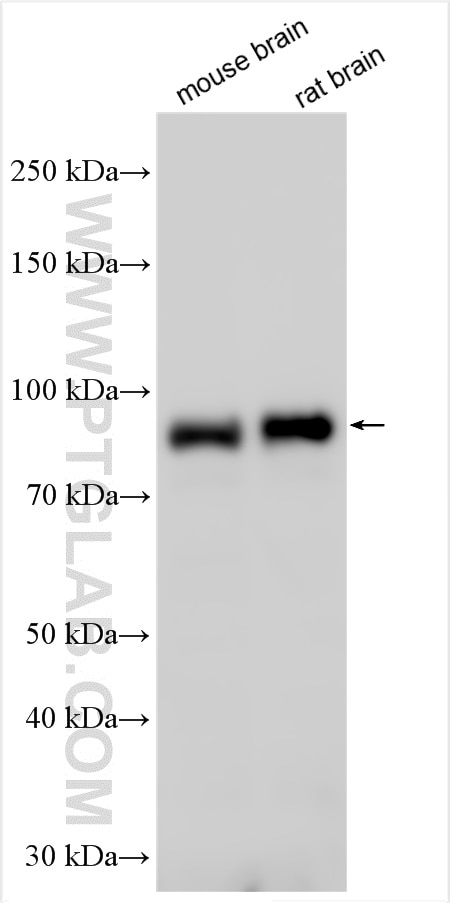 Western Blot (WB) analysis of various lysates using PRKG2 Polyclonal antibody (55138-1-AP)
