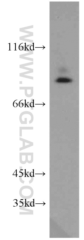 Western Blot (WB) analysis of mouse brain tissue using PRKG2 Polyclonal antibody (55138-1-AP)