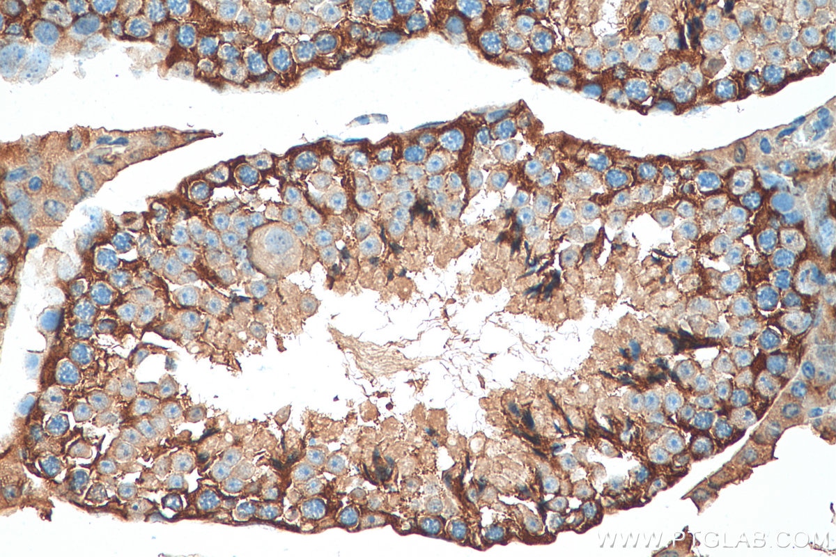Immunohistochemistry (IHC) staining of mouse testis tissue using PACT Polyclonal antibody (10771-1-AP)