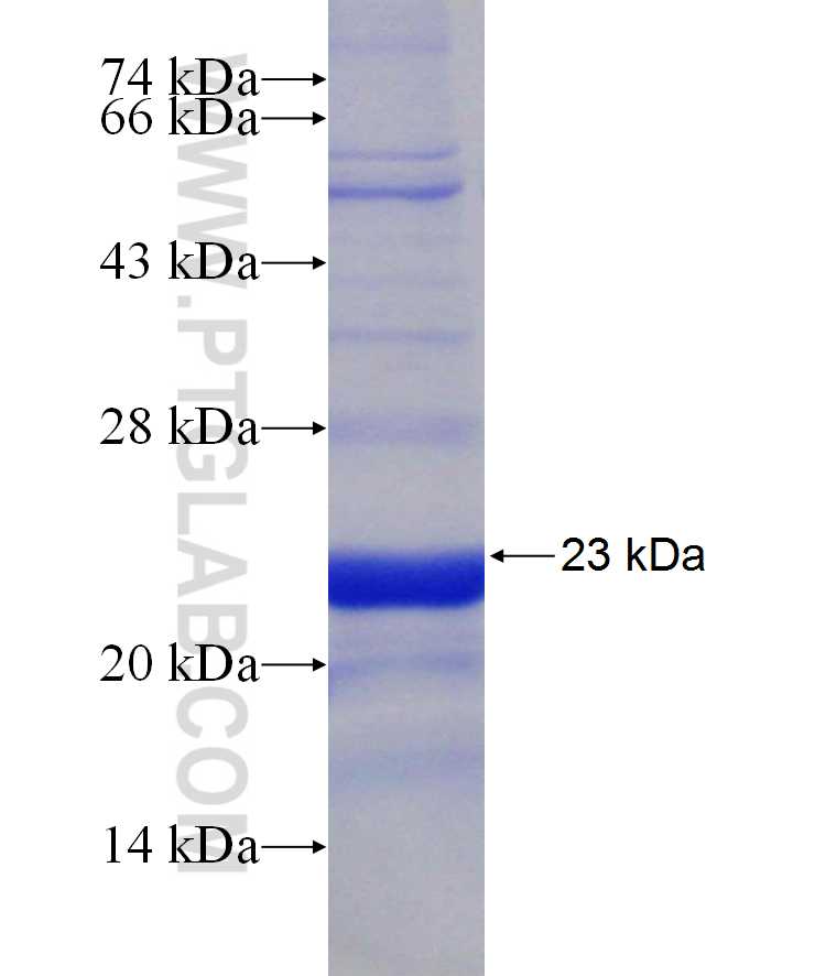 PRKRA fusion protein Ag29818 SDS-PAGE