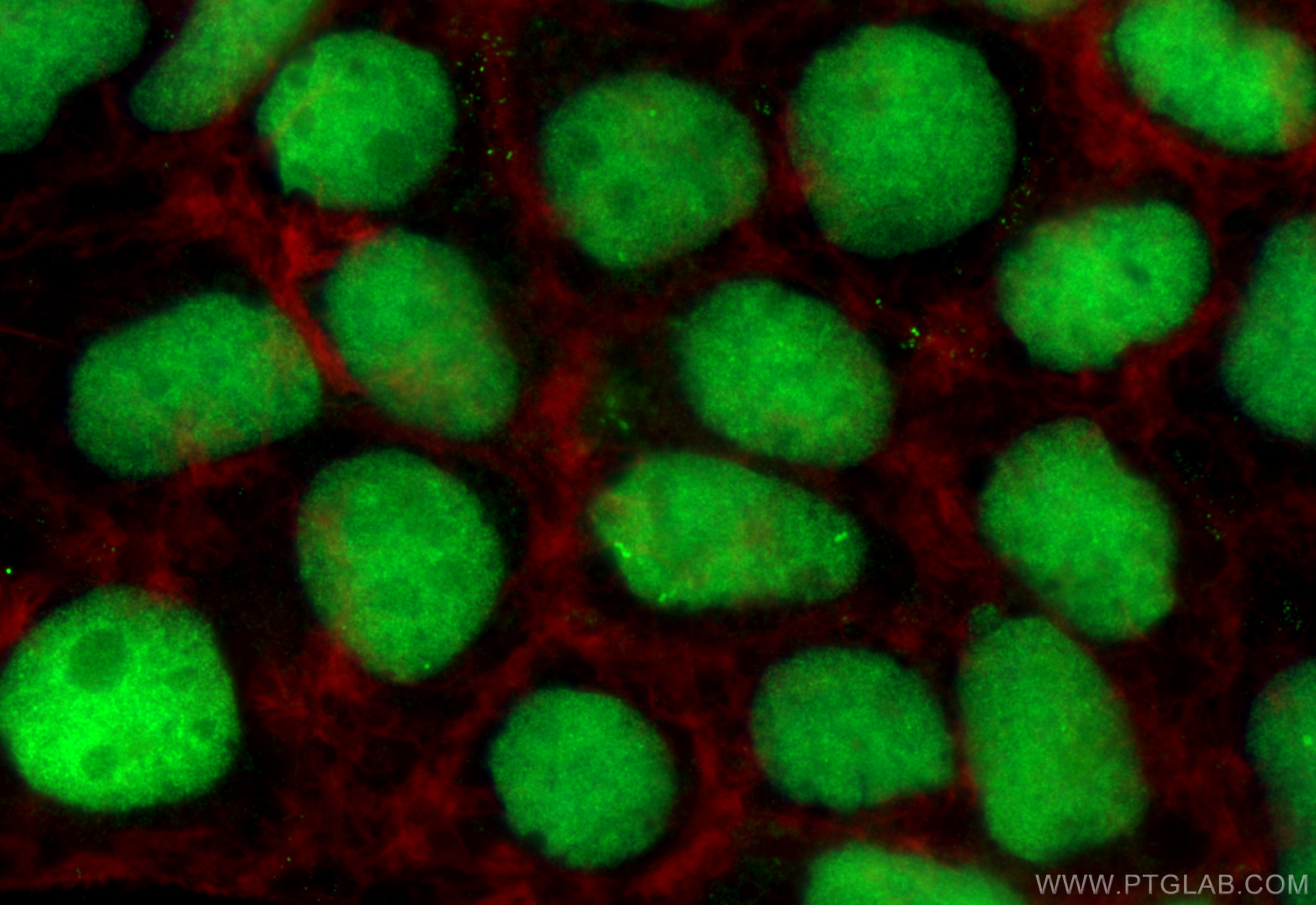 Immunofluorescence (IF) / fluorescent staining of Caco-2 cells using PRKRIP1 Polyclonal antibody (16794-1-AP)