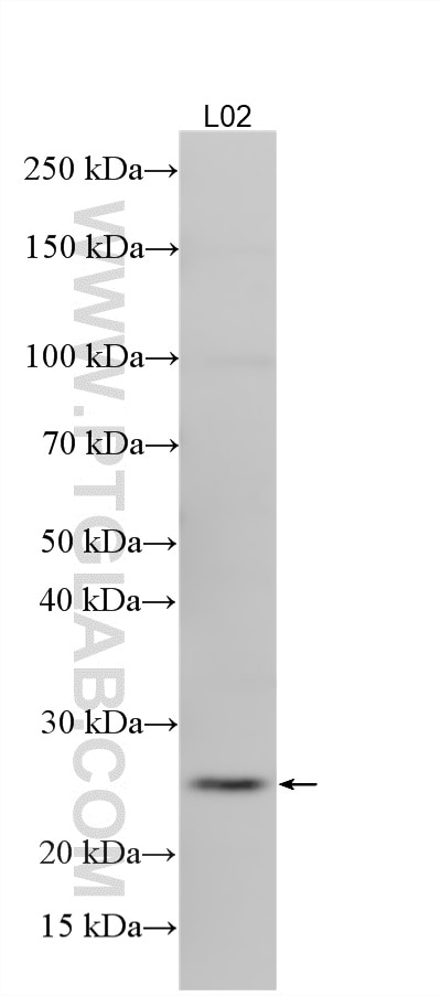 Various lysates were subjected to SDS PAGE followed by western blot with 16794-1-AP (PRKRIP1 antibody) at dilution of 1:4000 incubated at room temperature for 1.5 hours. Western Blot (WB) analysis of various lysates using PRKRIP1 Polyclonal antibody (16794-1-AP)