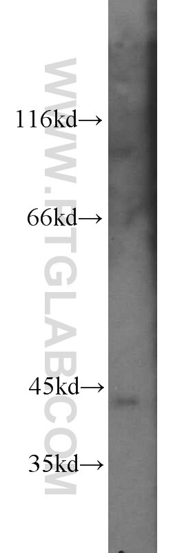 Western Blot (WB) analysis of Jurkat cells using PRKX Polyclonal antibody (16651-1-AP)