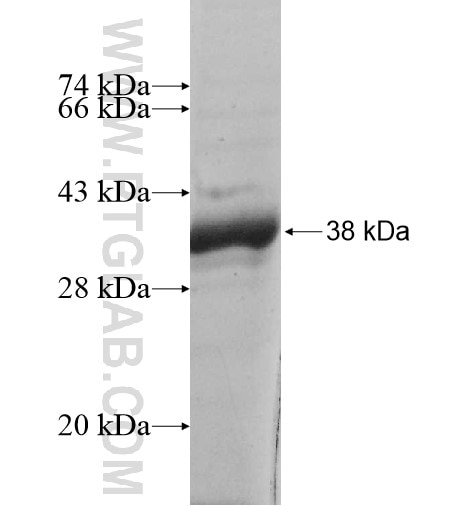 PRKY fusion protein Ag12404 SDS-PAGE