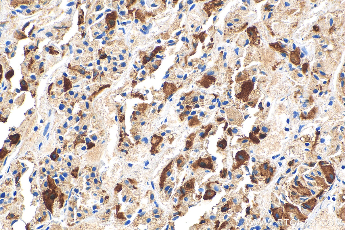 Immunohistochemistry (IHC) staining of human pituitary tissue using Prolactin Polyclonal antibody (16525-1-AP)