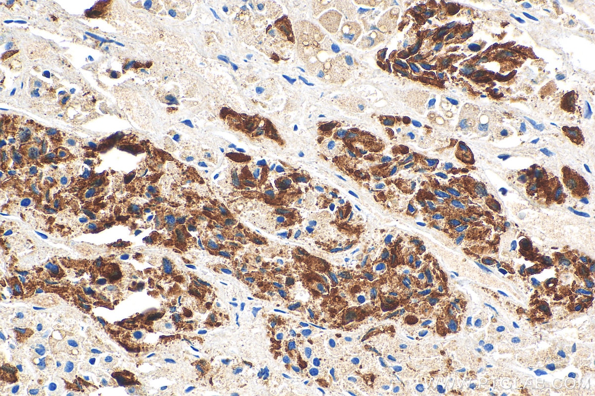Immunohistochemistry (IHC) staining of human pituitary tissue using Prolactin Polyclonal antibody (16525-1-AP)