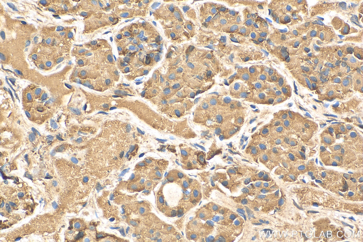 Immunohistochemistry (IHC) staining of human pituitary tissue using Prolactin Polyclonal antibody (16525-1-AP)