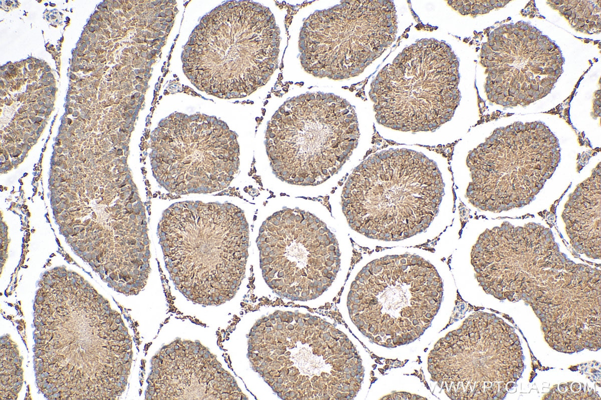 Immunohistochemistry (IHC) staining of rat testis tissue using Prolactin Polyclonal antibody (16525-1-AP)