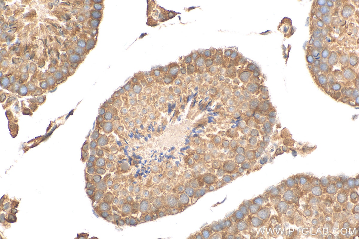 Immunohistochemistry (IHC) staining of mouse testis tissue using Prolactin Polyclonal antibody (16525-1-AP)