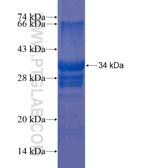 PRLHR fusion protein Ag20098 SDS-PAGE