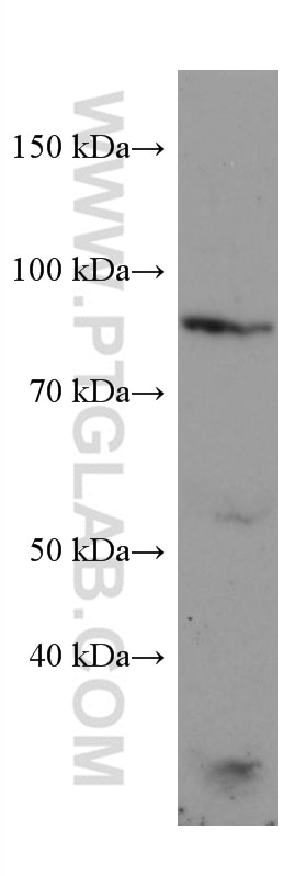 Western Blot (WB) analysis of A431 cells using PRLR Monoclonal antibody (67292-1-Ig)
