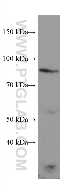 WB analysis of A431 using 67292-1-Ig