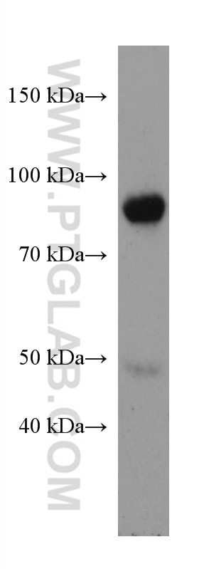 Western Blot (WB) analysis of T-47D cells using PRLR Monoclonal antibody (67292-1-Ig)