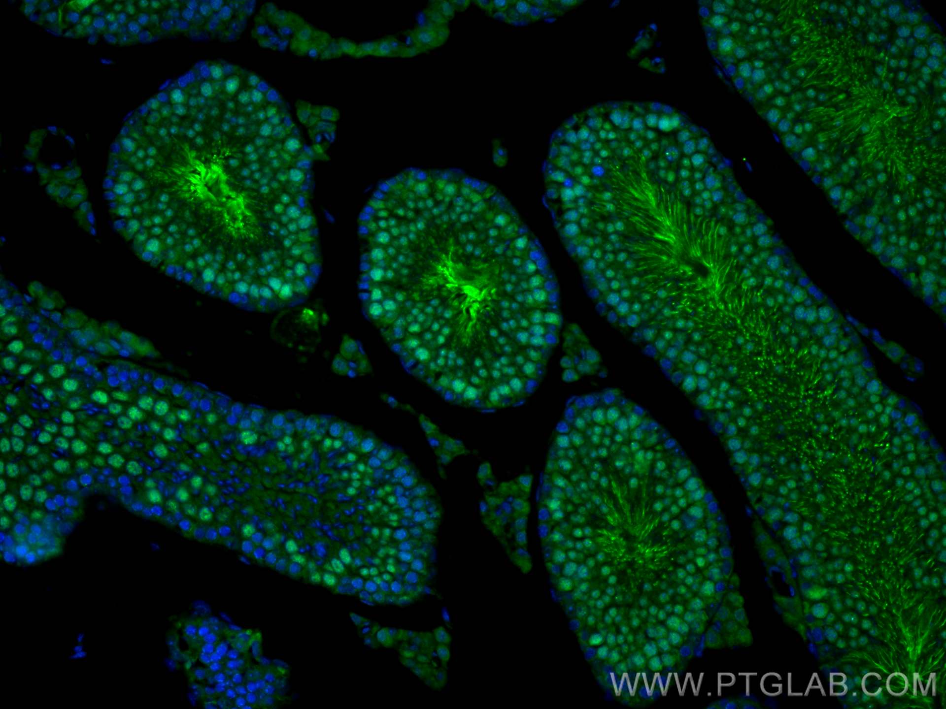 Immunofluorescence (IF) / fluorescent staining of mouse testis tissue using PRM1 Polyclonal antibody (15697-1-AP)