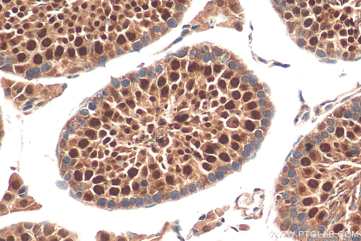 Immunohistochemistry (IHC) staining of mouse testis tissue using PRM1 Polyclonal antibody (15697-1-AP)