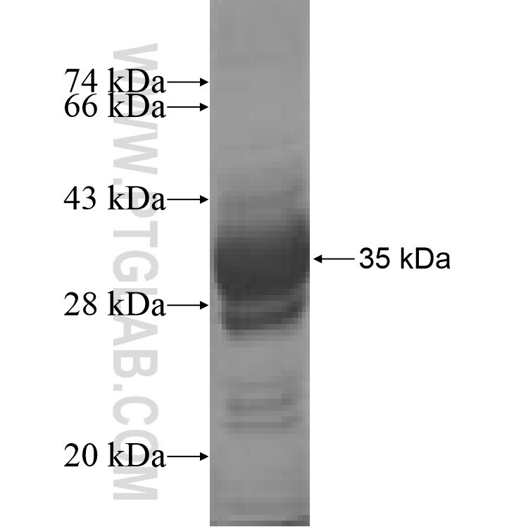 PRM1 fusion protein Ag8218 SDS-PAGE