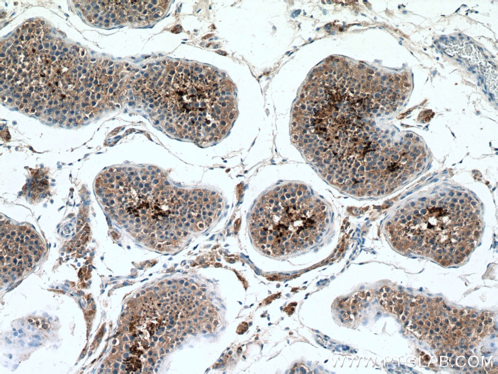 Immunohistochemistry (IHC) staining of human testis tissue using PRM2 Polyclonal antibody (14500-1-AP)
