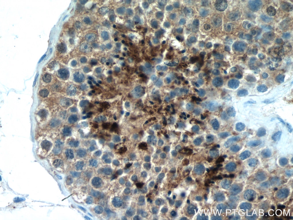 Immunohistochemistry (IHC) staining of human testis tissue using PRM2 Polyclonal antibody (14500-1-AP)