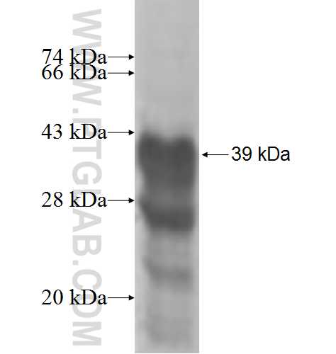 PRM2 fusion protein Ag5952 SDS-PAGE