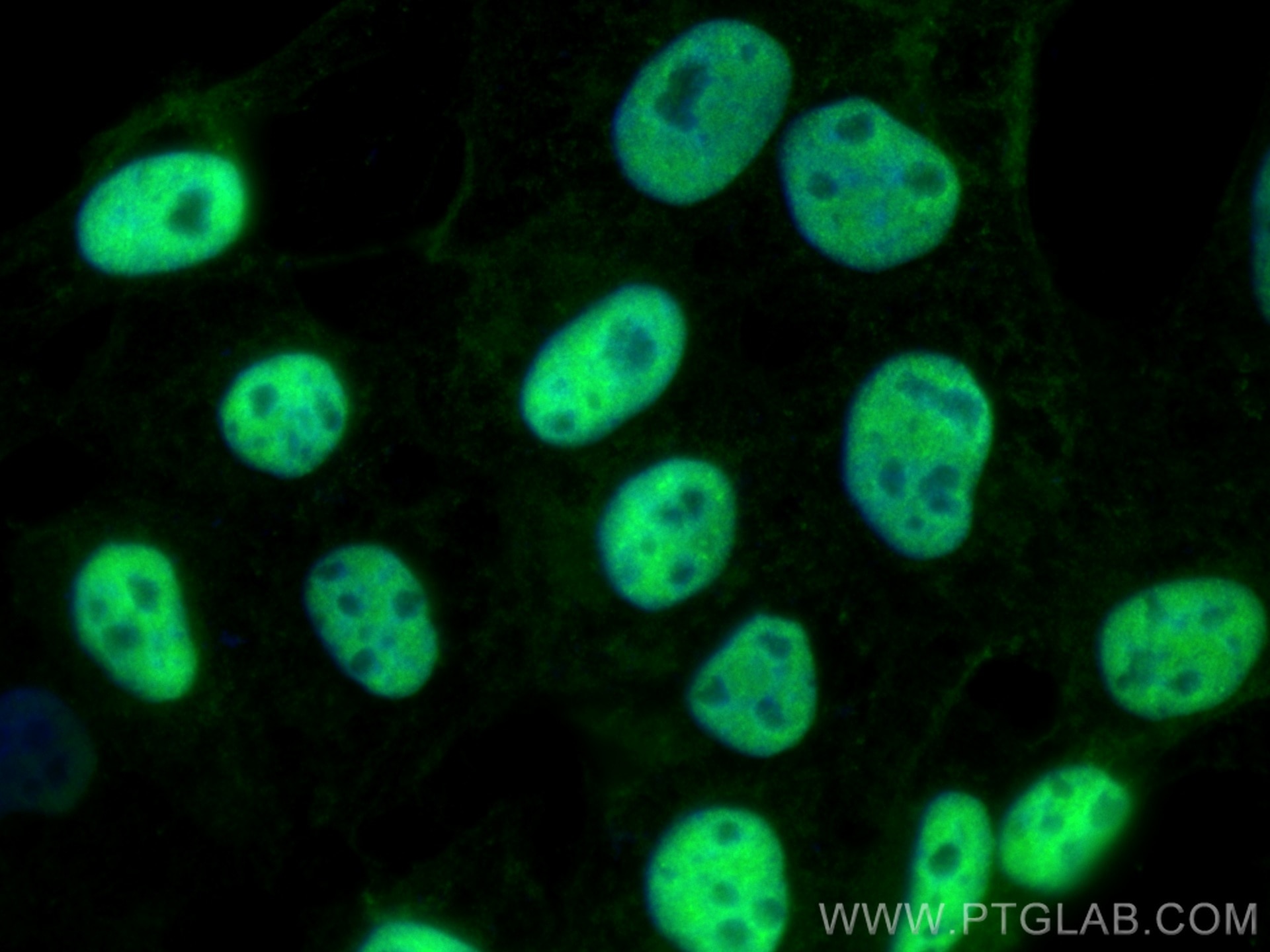 Immunofluorescence (IF) / fluorescent staining of A431 cells using PRMT1 Polyclonal antibody (11279-1-AP)