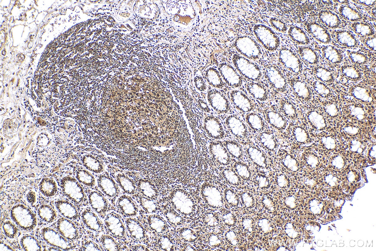 Immunohistochemistry (IHC) staining of human colon tissue using PRMT1 Polyclonal antibody (11279-1-AP)