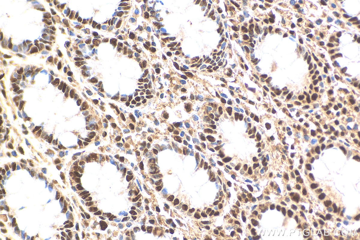 Immunohistochemistry (IHC) staining of human colon tissue using PRMT1 Polyclonal antibody (11279-1-AP)