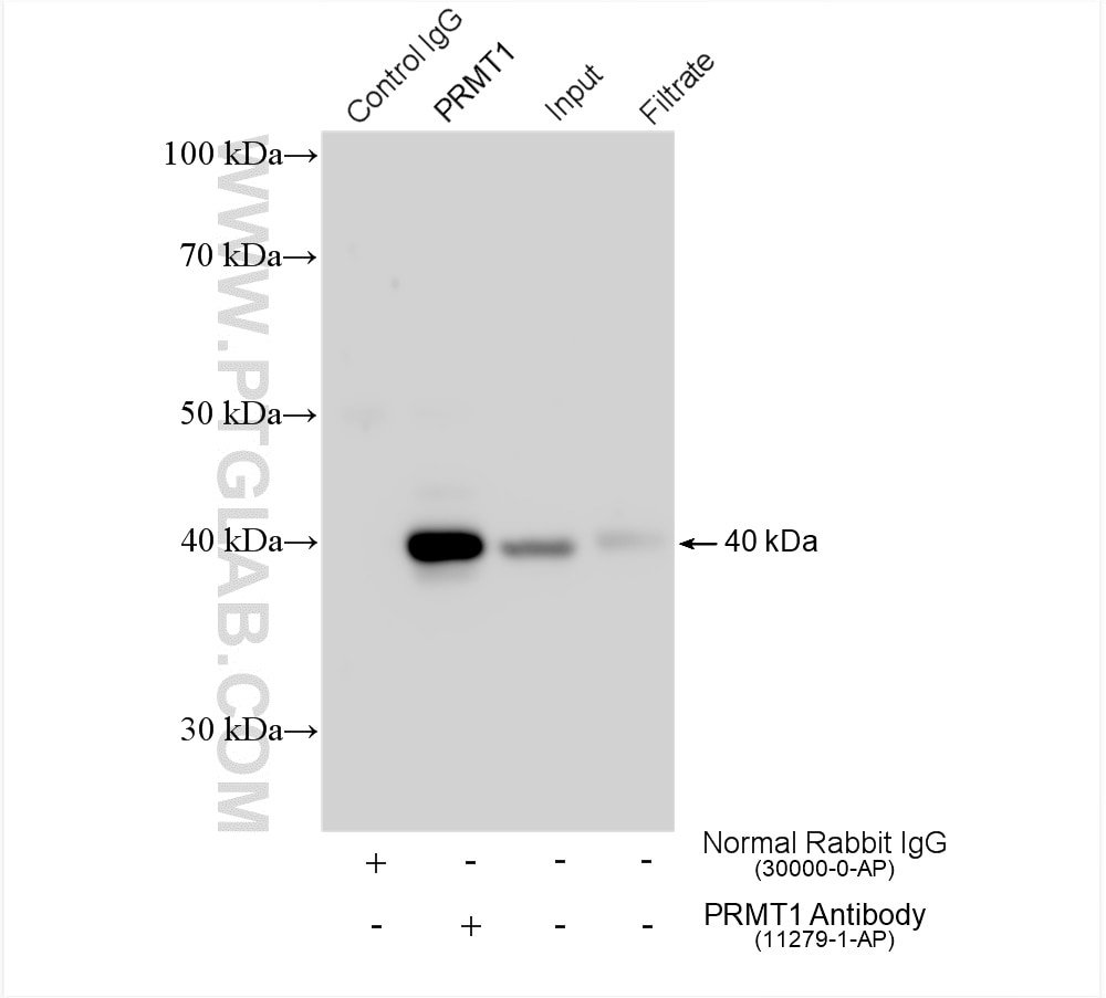 Immunoprecipitation (IP) experiment of A549 cells using PRMT1 Polyclonal antibody (11279-1-AP)