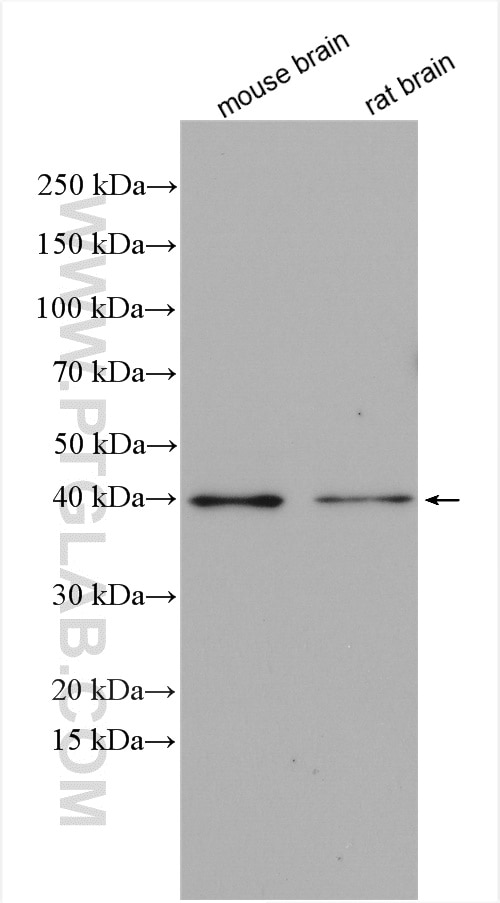 Western Blot (WB) analysis of various lysates using PRMT1 Polyclonal antibody (11279-1-AP)