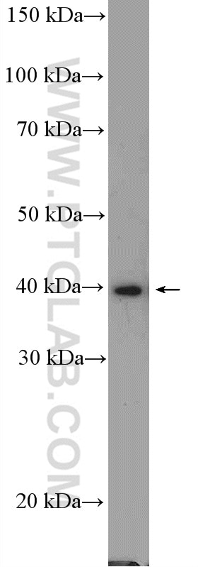 PRMT1 Polyclonal antibody