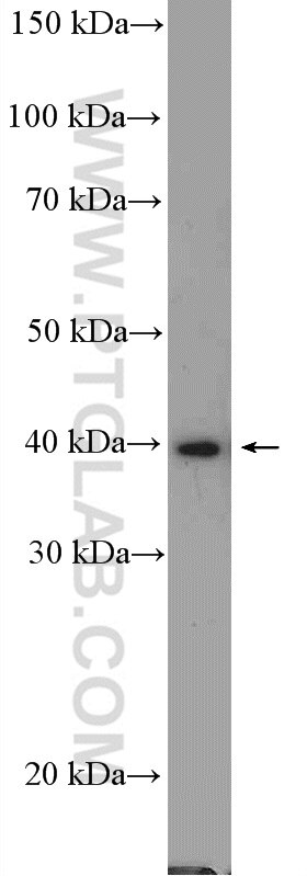 PRMT1 Polyclonal antibody