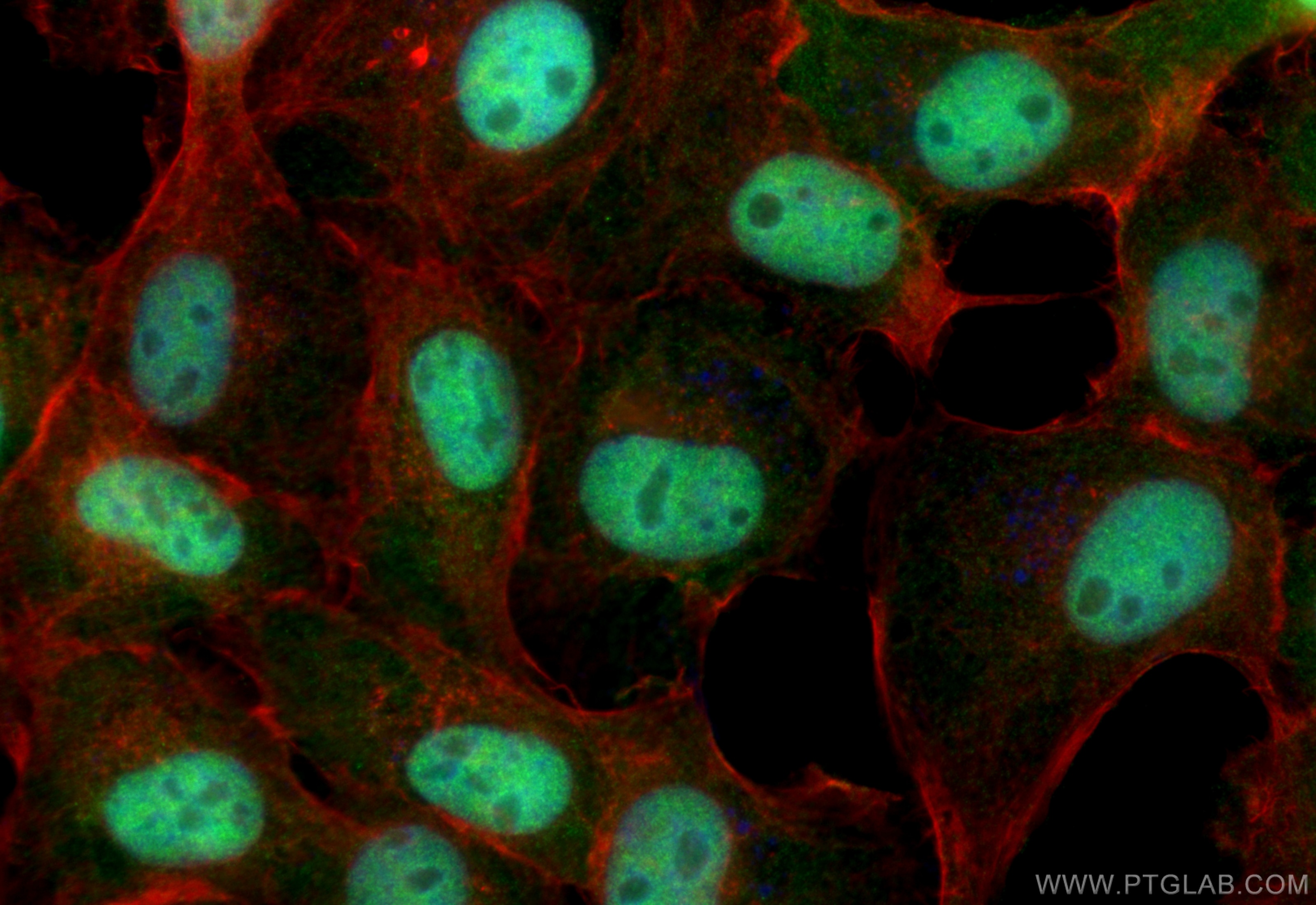 Immunofluorescence (IF) / fluorescent staining of A431 cells using PRMT1 Monoclonal antibody (68365-1-Ig)